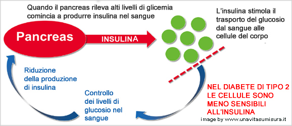 diabete