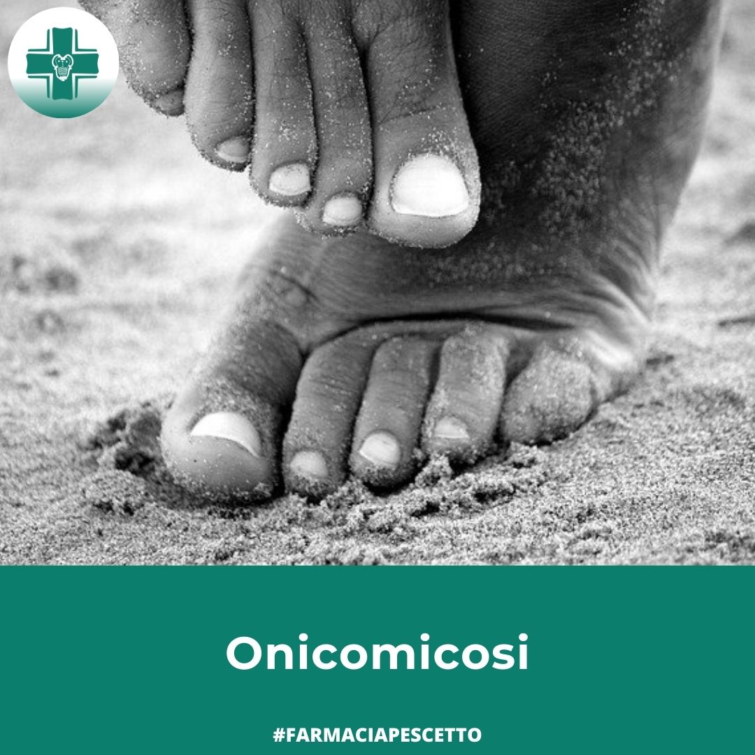 Onicomicosi