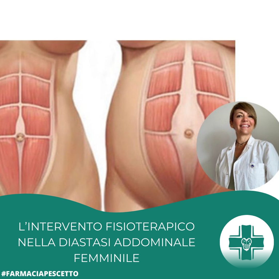 DIASTASI addominale