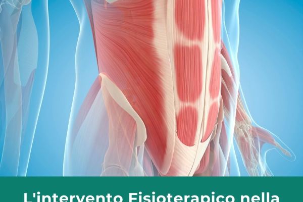 diastasi addominale femminile